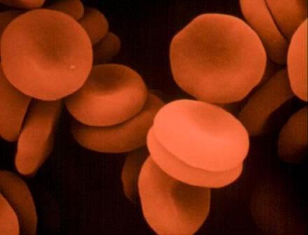 Τι αυξάνει την αιμοσφαιρίνη καλύτερα;