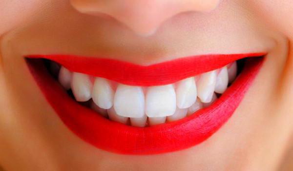 Laminating δόντια: μια περιγραφή της διαδικασίας, σχόλια