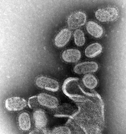 Ο ιός της γρίπης